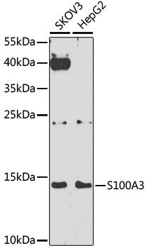 S100A3 Polyclonal Antibody