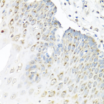 STAU1 Polyclonal Antibody
