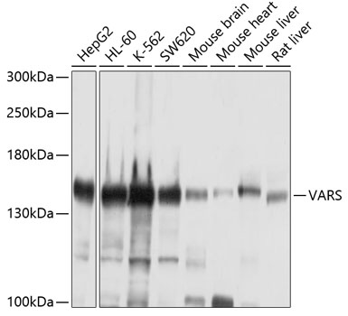 VARS Polyclonal Antibody