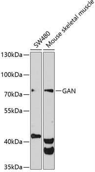 GAN Polyclonal Antibody
