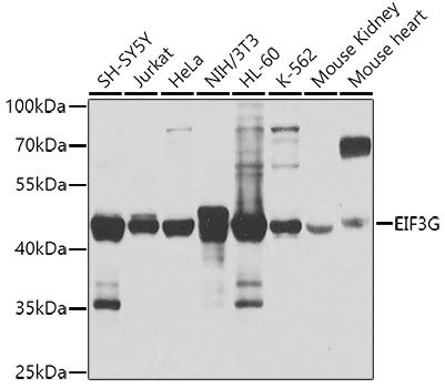 EIF3G Polyclonal Antibody