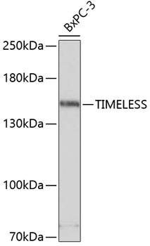 TIMELESS Rabbit Polyclonal Antibody