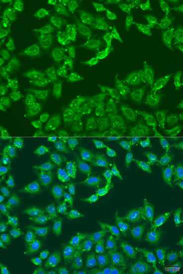 ADAP1 Rabbit Polyclonal Antibody