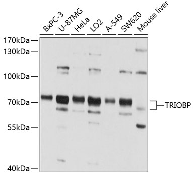 TRIOBP Polyclonal Antibody