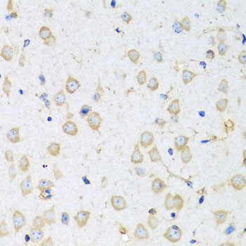 COTL1 Polyclonal Antibody