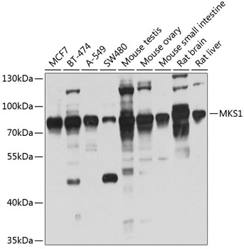 MKS1 Polyclonal Antibody