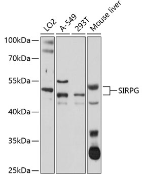 SIRPG Polyclonal Antibody