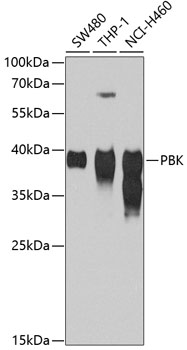 SPK Polyclonal Antibody