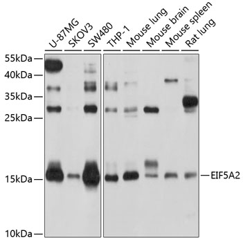 EIF5A2 Polyclonal Antibody