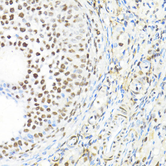 BACH1 antibody