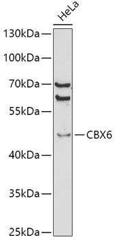 CBX6 Rabbit Polyclonal Antibody