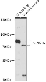 SCNN1A Rabbit Polyclonal Antibody