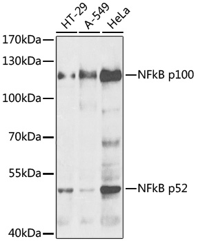 NFkB p100 / p52 Rabbit Polyclonal Antibody