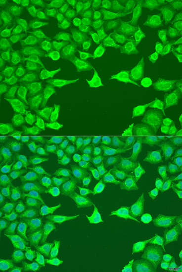 ATG9A Rabbit Polyclonal Antibody