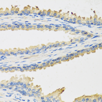 LEP Antibody