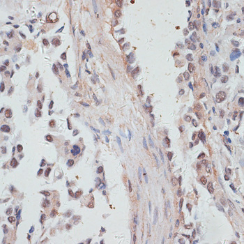 NCOA4 Antibody