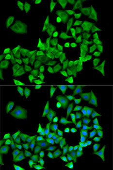 PPP2R1A Antibody