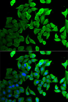 SEPT2 Antibody