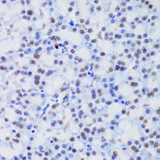 JMJD6 Antibody