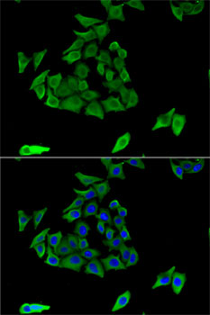 TGM3 Antibody