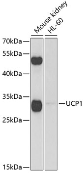 UCP1 antibody