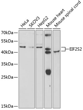 EIF2S2 Antibody