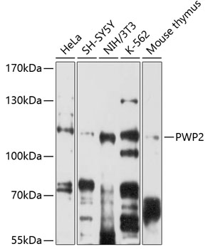 PWP2 Polyclonal Antibody