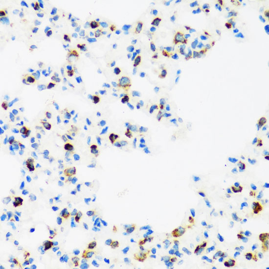 FMR1 Rabbit Polyclonal Antibody
