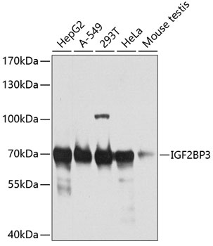IGF2BP3 Rabbit Polyclonal Antibody