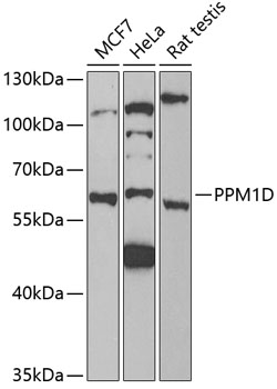 PPM1D Antibody