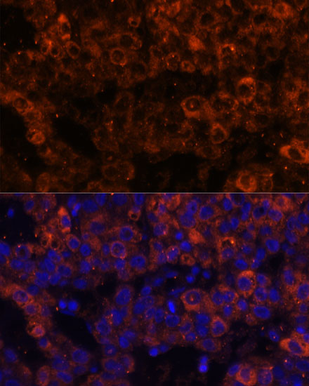 SERPINE1 antibody