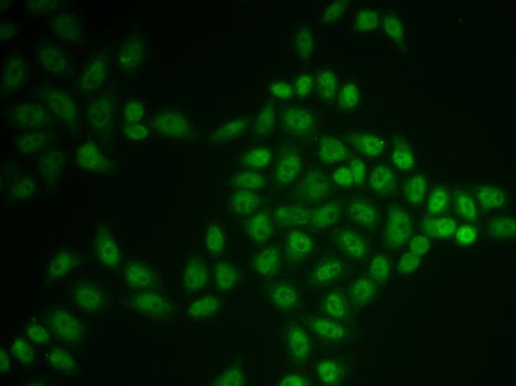 BTG1 antibody
