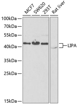 LIPA Rabbit Polyclonal Antibody