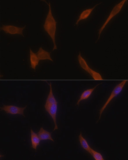 MLPH antibody