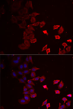 P2RX4 antibody