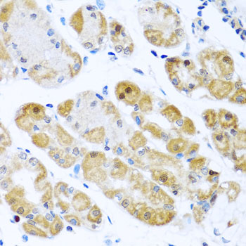 RPS2 Rabbit Polyclonal Antibody