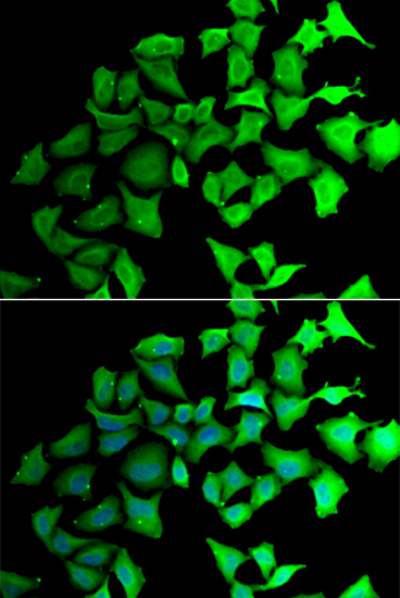 TALDO1 antibody