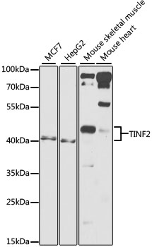 TINF2 Polyclonal Antibody
