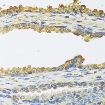 TSHB antibody