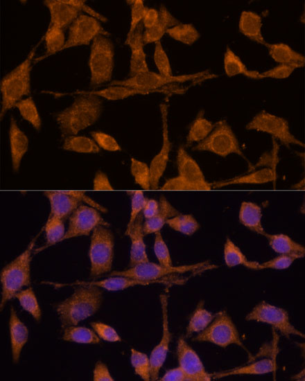 USP15 Rabbit Polyclonal Antibody