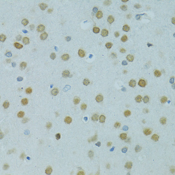 MUS81 Polyclonal Antibody