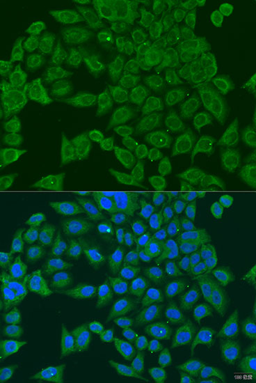 PIWIL1 Rabbit Polyclonal Antibody