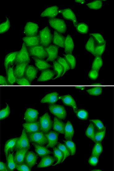 ASPH Polyclonal Antibody