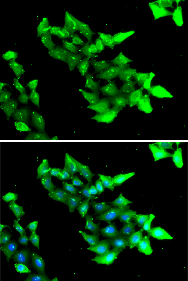 KRIT1 Polyclonal Antibody