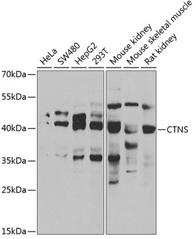 CTNS Polyclonal Antibody