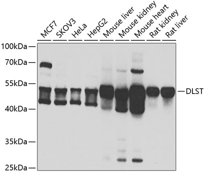 DLST Polyclonal Antibody