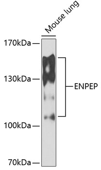 ENPEP Rabbit Polyclonal Antibody