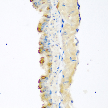 MSTN Rabbit Polyclonal Antibody