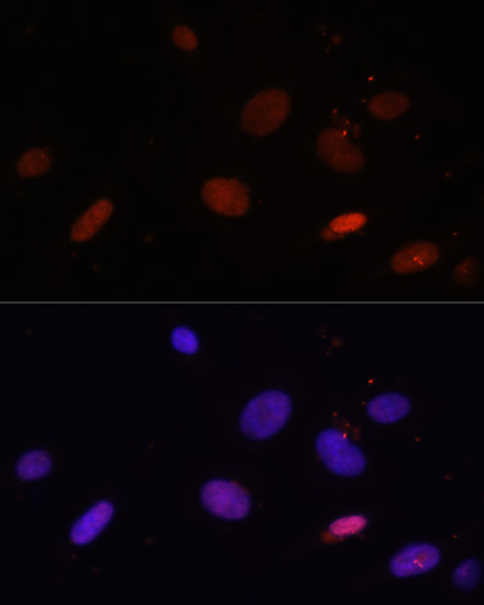 Histone H1.0 Rabbit Polyclonal Antibody