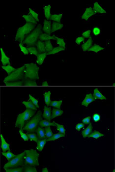 HABP2 Rabbit Polyclonal Antibody